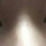 <b>쌍수</b> 2일찬데 <b>라인</b> 너무 두꺼워?