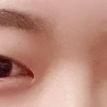 나 안검<b>하수</b>인거임 걍 지방이 많은거임