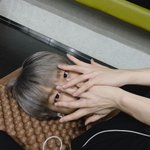 [댓글부탁해] 피부과 가서
