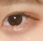 쌍액 많이 <b>티나</b>??