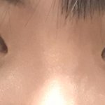 [이것좀봐줘] 나 <b>코</b>수술 어디할까