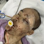 [도와주세요] (사진있음/수정) 폐쇄 정신병동에서 조현병 환자에게...