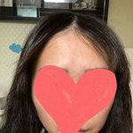 (사진있음)펌했는데 심각해요! <b>민사</b>소송까지 생각중입니다