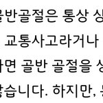 골반<b>골절</b>은 교통사고 정도가 아니면 잘 발생하지 않는대