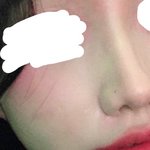 [드루와] 나 <b>코에</b> 점있는데 어때??