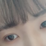 쌍수 <b>재수술</b>할까?