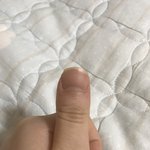내 손톱 왜이렇게