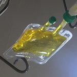 이 <b>주사</b> 뭔지 아시는분 계시나요?