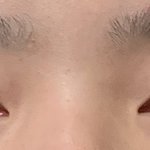 [댓글부탁해] 눈매교정해야해? 사진있음