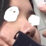 나 <b>코가</b> 너무 짧아