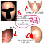 [혐주의] 2019년 내 <b>피부</b> <b>변천사</b> 볼사람ㅌㅋㅋ
