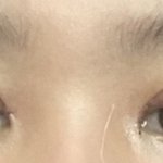 쌍수 라인좀봐줭 2일<b>차야</b>