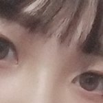[댓글부탁해] (약혐(쌍수일주일찬데 망한거냐진짜