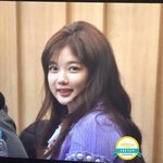 사랑니 뽑은 김유정 ㅋㅋㅋㅋ