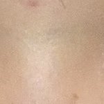 [드루와] 쌍수하면 어떨거같아 ㅠㅠ?