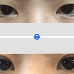 [추반] <b>쌍수</b> 후기 어때?