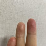 와 손가락에 <b>지문</b> 없어짐