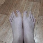 [드루와] 수족냉증 심하면 원래 이래?