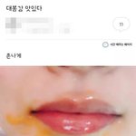 방학 하니까 약간 병원 <b>입원</b>한 것 같음