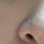 [댓글부탁해] 혐) 피부<b>각질</b> 어케 해??ㅠㅠㅠ