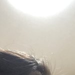 [댓글부탁해] 와... 내 <b>이마</b> 실화냐...