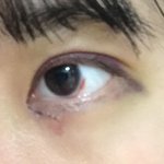 쌍수 <b>속</b><b>쌍</b>될 거 같아?