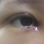 혐) 쌍수 <b>속쌍</b> 될 거 같아?