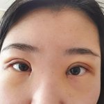 [꼭조언부탁] 저 앞트임 잘 된건가요?