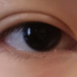 나 눈 <b>재수술</b>해야 하는데 어느 눈이 나아?