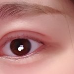 혹시 나 쌍수 망한거 같니