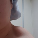 [댓글부탁해] 승모근 <b>종지부</b>찍으러왔다