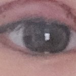 나 절개 2일<b>차라</b> 눈이 ㅇ따군ㄷ(혐주의)