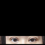 [댓글부탁해] 쌍수 10일<b>차인</b>뎅 붓기어때?