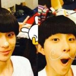 [NCT] 정우 볼에 점 뺀거지?