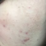 나 피부 ㅈㄴ <b>안</b>좋은데 (<b>사진</b> ㅇ)