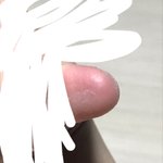 [댓글부탁해] 나 <b>엄지</b> 이렇게 됐는데