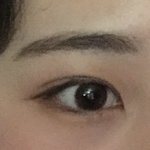 나 <b>쌍수</b> 한 <b>티</b> 나??