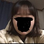 야 얘들아 나 <b>볼살</b> 없는편임 있는 편임 걍 그저그럼