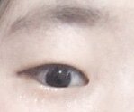 [조언부탁해] 봄에 쌍수 괜찮을까? 걱정돼 ㅠㅠㅠ