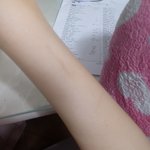 나 이거 <b>자해</b> 자국 같애?