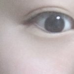 [꼭조언부탁] 쌍수 추반 부탁해 !!!
