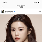 애드라 나 쌍수 상담 받았는데