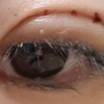 쌍수 붓기 확 빼는 <b>확실</b>한 개꿀팁