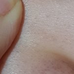 혐주의)나만큼 블랙<b>헤드</b> 많은 사람 있냐..ㅅ ㅂ