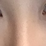 [댓글부탁해] 눈 앞머리 이러면 앞트임해여함??