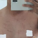 [꼭좀읽어줘] 남편가슴에 손바닥<b>자국</b>이...귀신짓일까요?