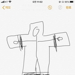 어제한 리얼 쌍수후기!(수면마취,매몰,앞트임 광고 <b>절대X</b>)