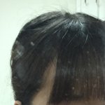 얘들아 이렇게 머리 비어보이는 거 어떻게해