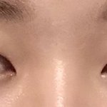 [댓글부탁해] 사진) 너네가 나라면 <b>쌍수</b>해???