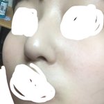 나 <b>피부</b> <b>개</b>조아